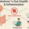 Alzheimer's Gut Health & Inflammation infographic showing the gut-brain connection, inflammation triggers like alcohol, and protective strategies such as diet, omega-3s, and strength training.