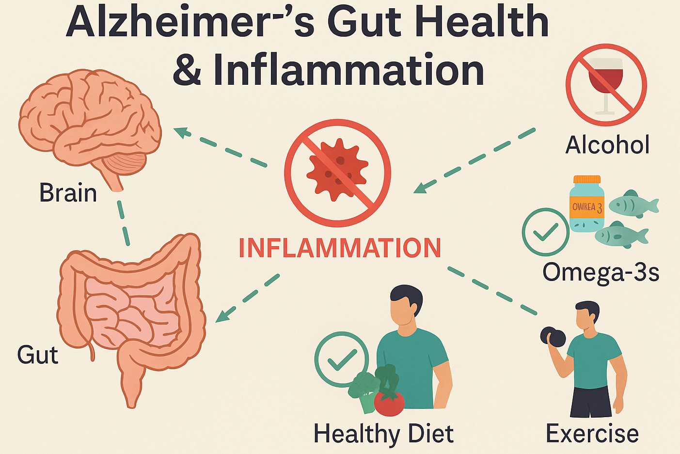 Alzheimer's Gut Health & Inflammation infographic showing the gut-brain connection, inflammation triggers like alcohol, and protective strategies such as diet, omega-3s, and strength training.