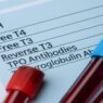 Hashimoto's Test Guide– blood samples and thyroid lab form showing TSH, Free T3, Free T4, Reverse T3, and antibody markers